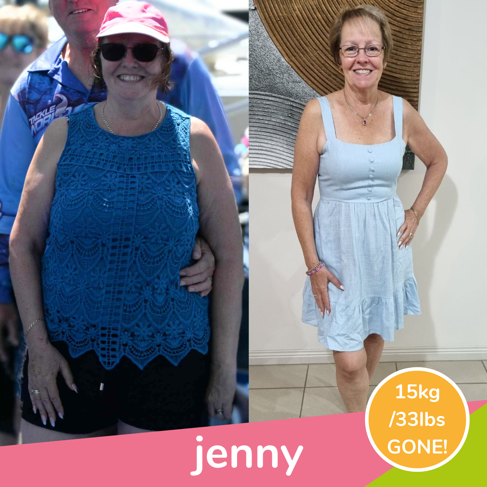 Jenny transformation